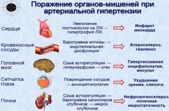 Нефрогенная артеріальна гіпертензія: ознаки хвороби