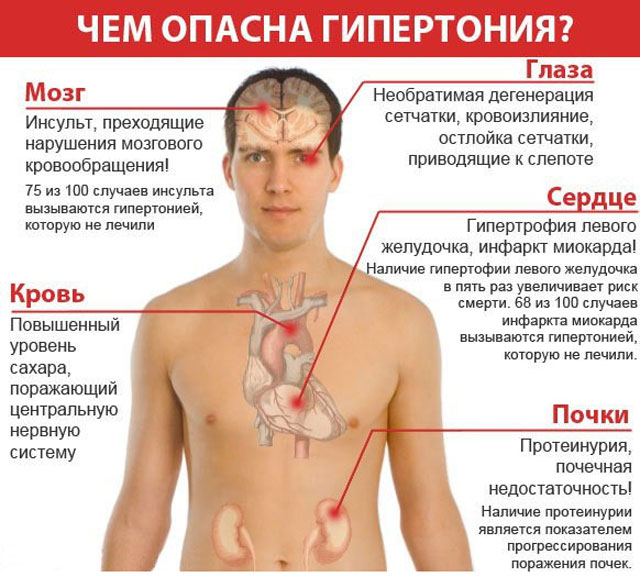 Тиск 170: про що говорить цей показник і як його знизити