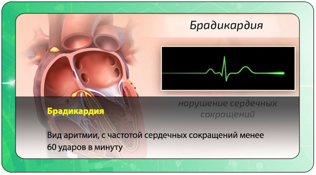 Домашні методи підвищення пульсаКак підвищити пульс в домашніх умовах швидко і ефективно