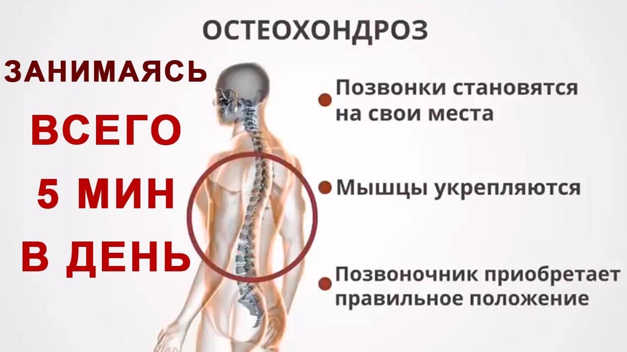 Шийний остеохондроз і артеріальний тиск