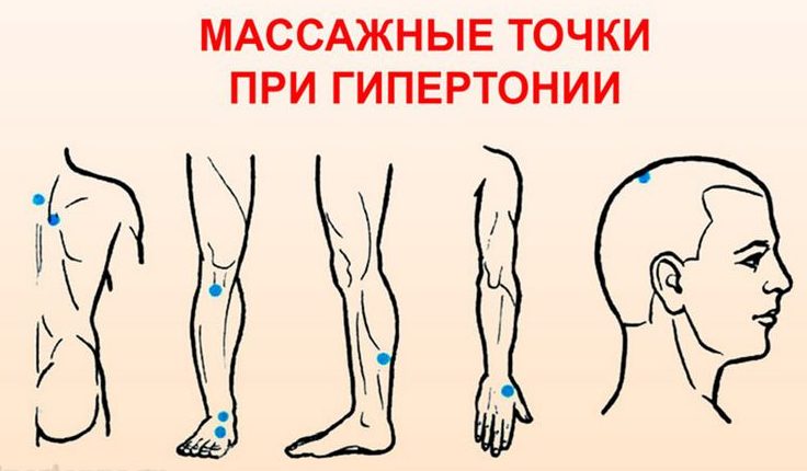 Як вилікувати гіпертонію назавжди: 2 способи лікування