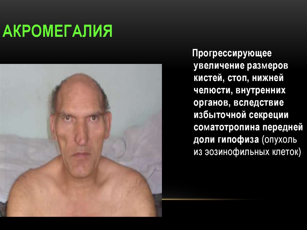 Ендокринні артеріальні гіпертензії – види захворювань