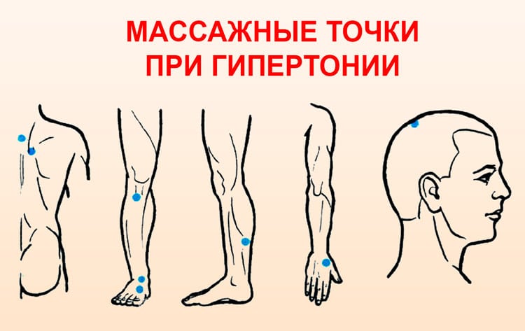 Високий тиск: як знизити в домашніх умовах