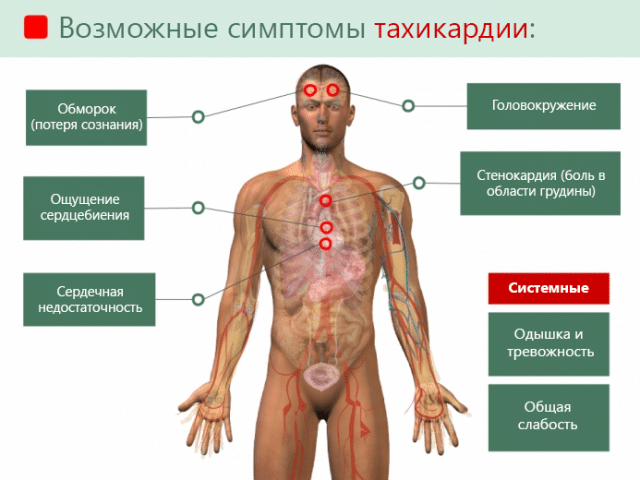 Причини підвищення і пониження пульсаСкачет пульс: причини і симптоми проблеми – брадикардії