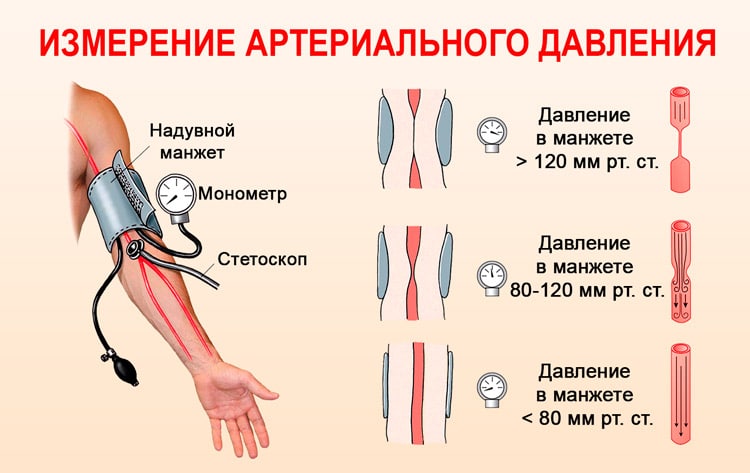 На якій руці правильно міряти тиск?