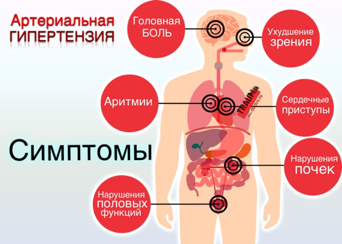Хто такі гіпертоніки і хто відноситься до групи ризику захворювання