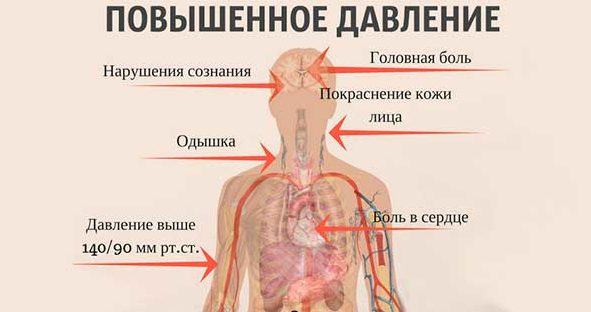 Високий тиск: як знизити в домашніх умовах