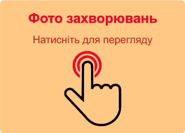 Червоні плями на голівці статевого члена
