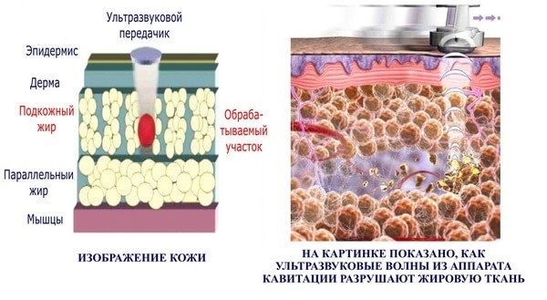 Як зробити талію тонше і прибрати живіт. Обгортання, вправи, фитосборы20